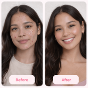 Spots at Bay Cleanser